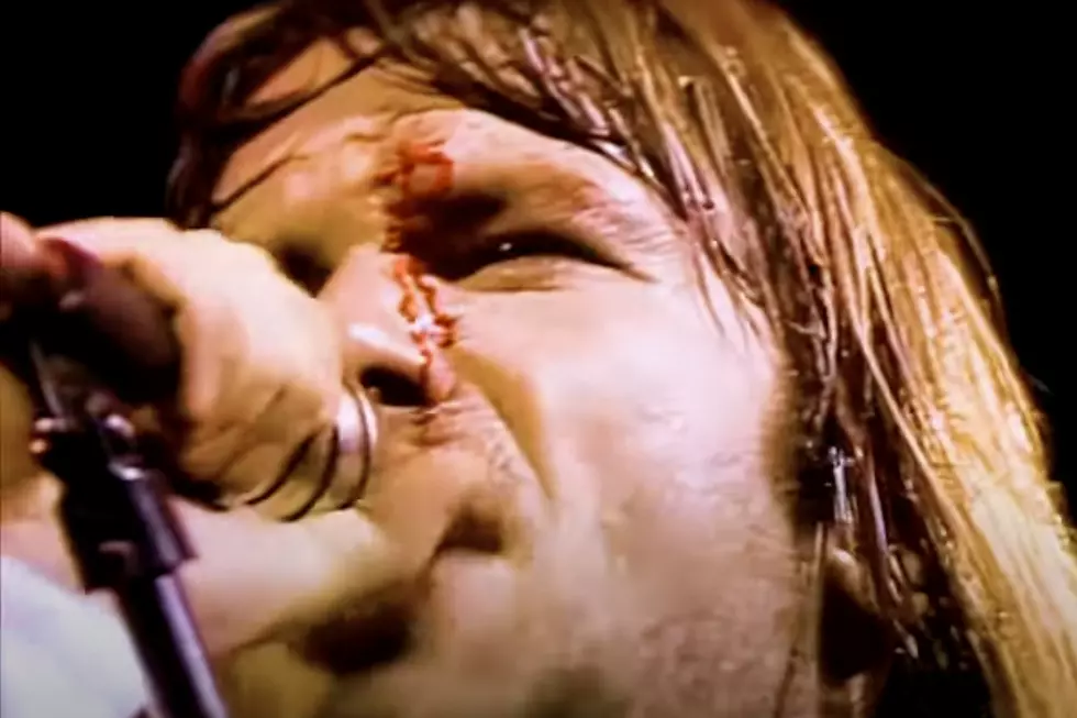 How Bruce Dickinson’s Onstage Injury Helped Iron Maiden Break the US